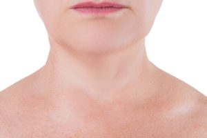 neck-lift-sagging-neck